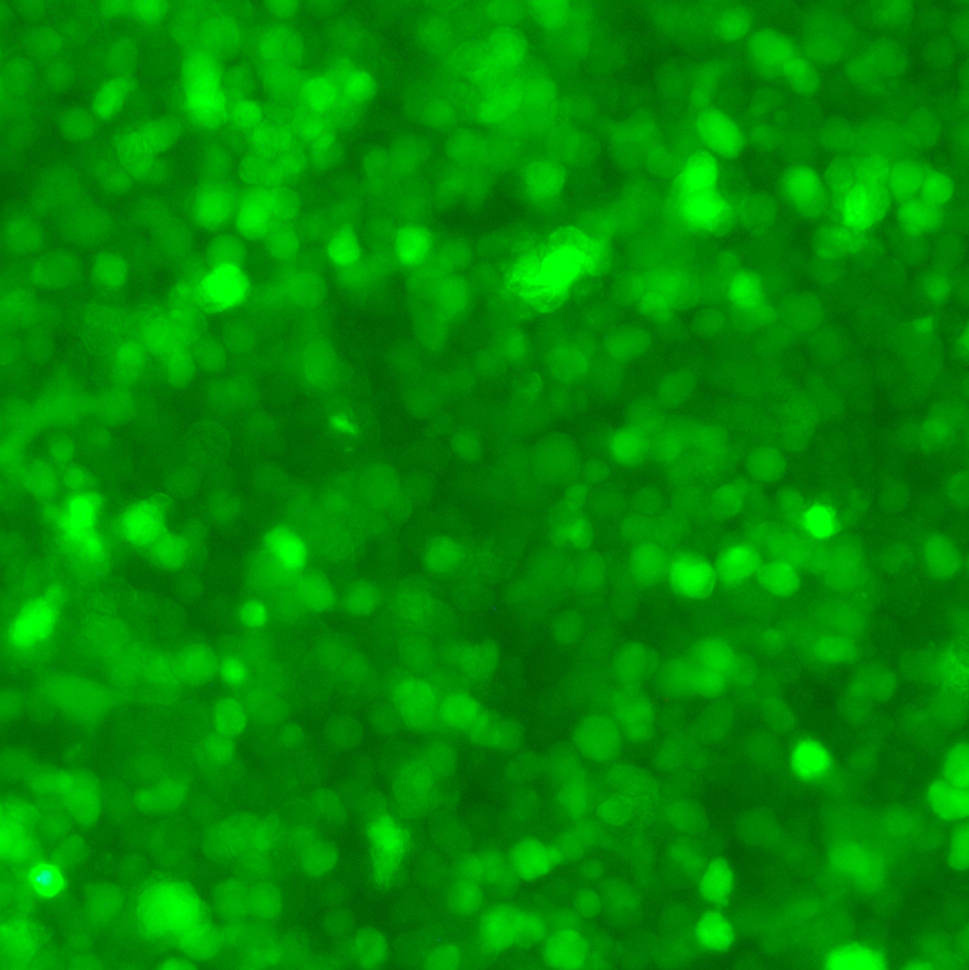 ARD-LUC-GFP双标记的人多发性骨髓瘤细胞