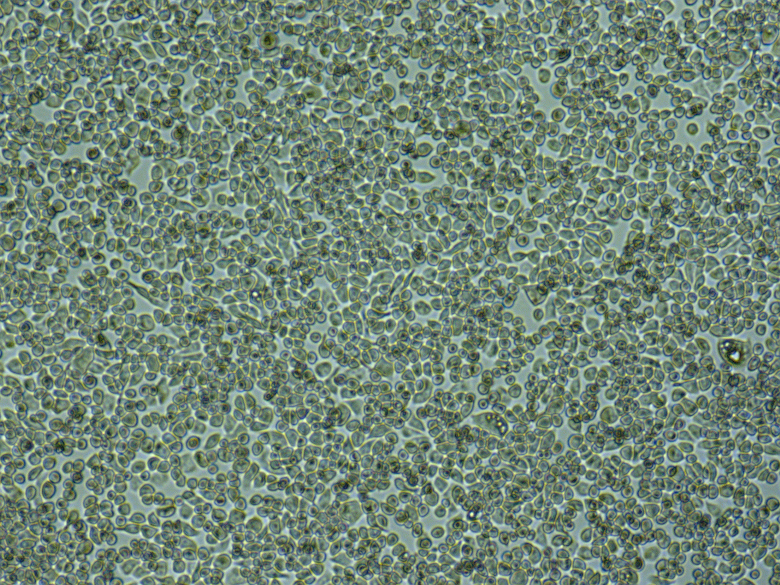 NUGC-4人胃癌细胞