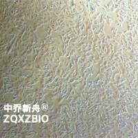 U251MG/TMZ 人类星形胶质瘤耐替莫唑胺细胞