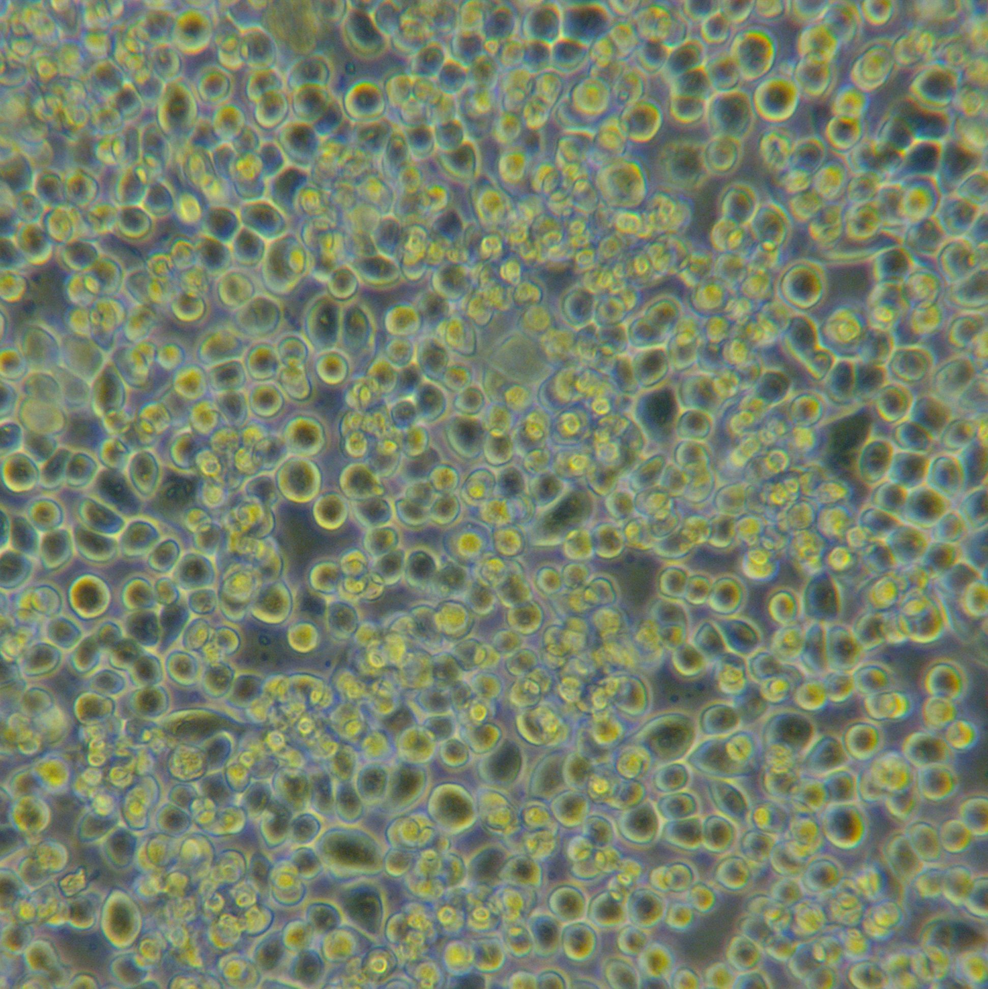 NUGC-4人胃癌细胞