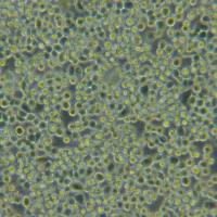 NUGC-4人胃癌细胞