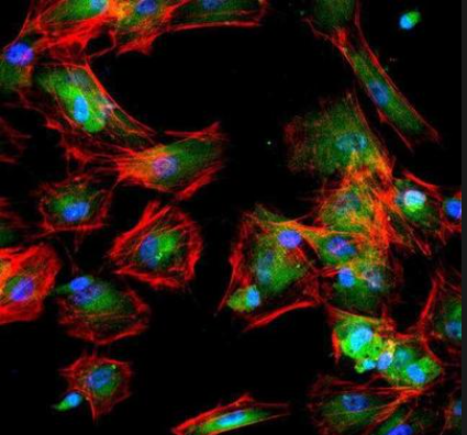 免疫荧光染色原理是什么