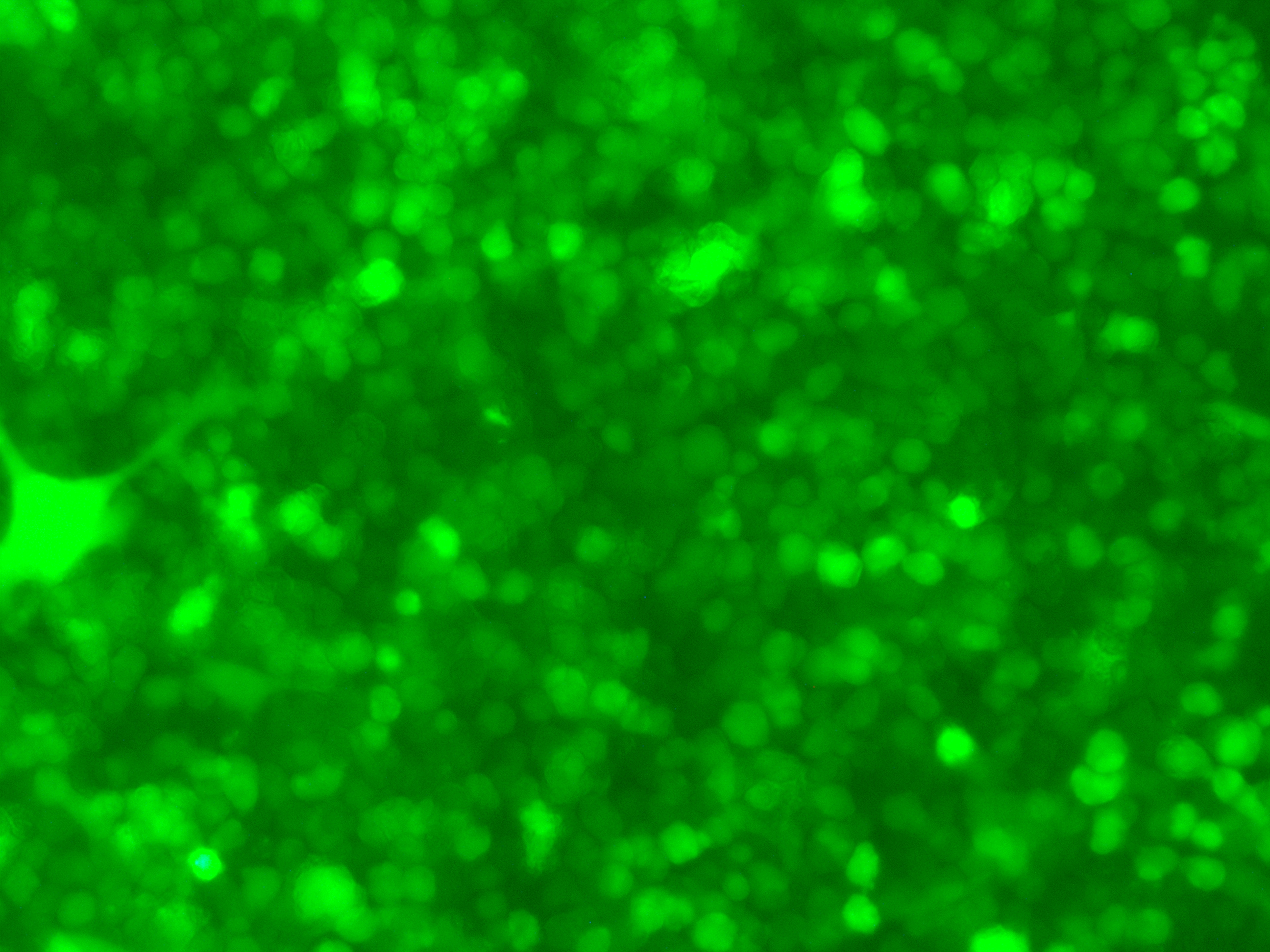 ARD-LUC-GFP双标记的人多发性骨髓瘤细胞