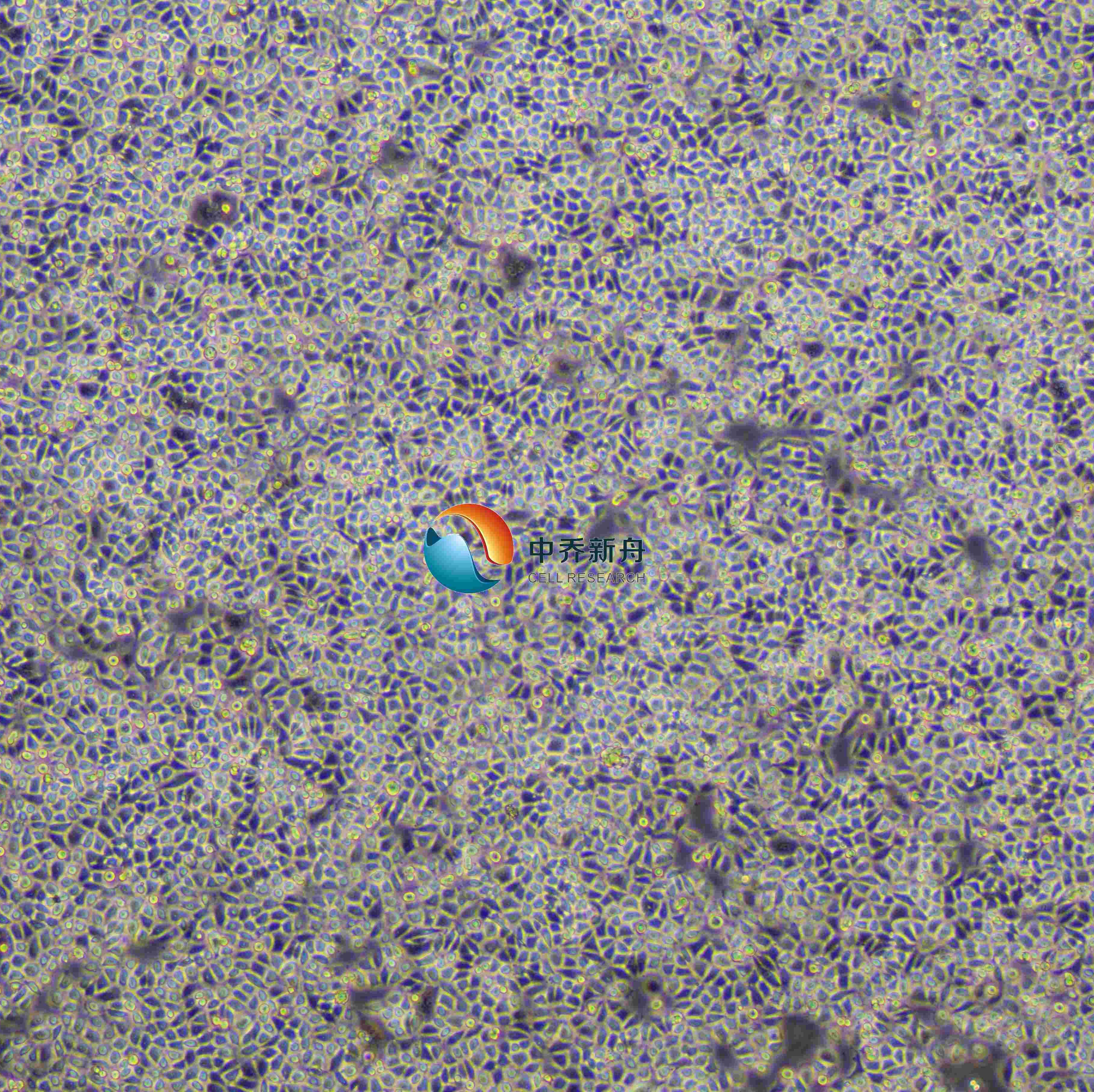 HeLa-luc人宫颈癌细胞-荧光素酶标记 