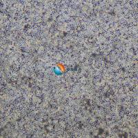 HeLa-luc人宫颈癌细胞-荧光素酶标记