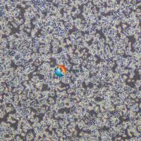 MCF7 [MCF-7]-luc人乳腺癌细胞-荧光素酶标记