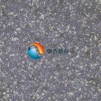 HCT-116/Oxaliplatin 结肠癌耐奥沙利铂耐药株