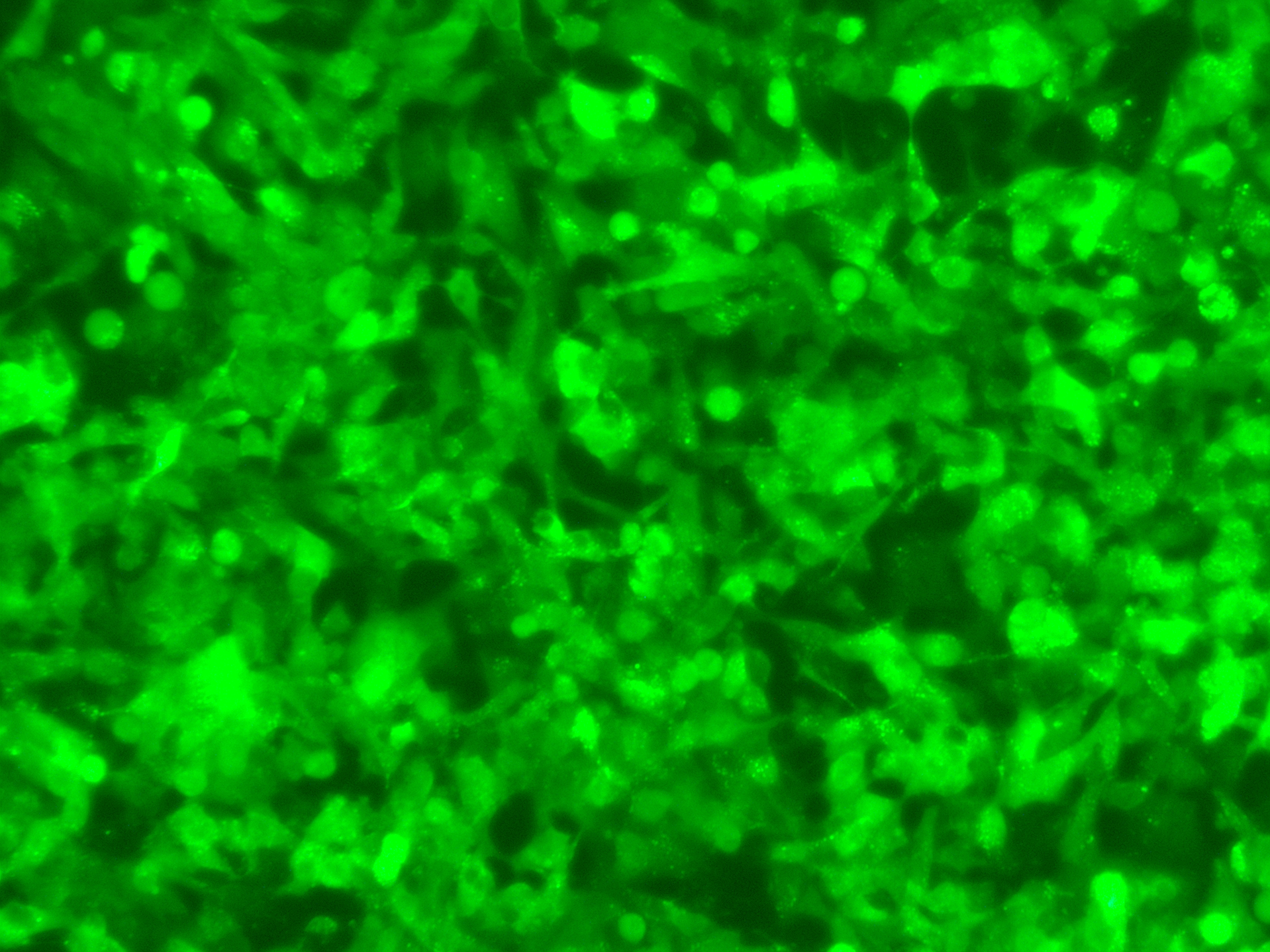 MM.1S-LUC-GFP双标记的人IgA-骨髓瘤细胞