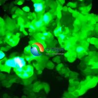 MCF7 [MCF-7]-GFP人乳腺癌细胞-绿色标记 