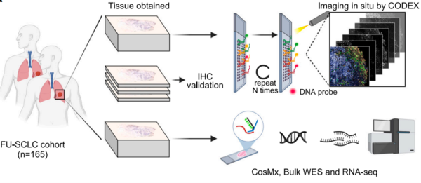 空间多组学揭示小细胞肺癌肿瘤异质性和与临床预后相关的免疫生态位