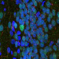 Rabbit Polyclonal Antibody to Adenylate Cyclase III