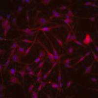  默克Merck SMA-560 Mouse Orthotopic Glioma Cell Line