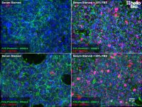 Anti-Ki-67 antibody ValidAb TM