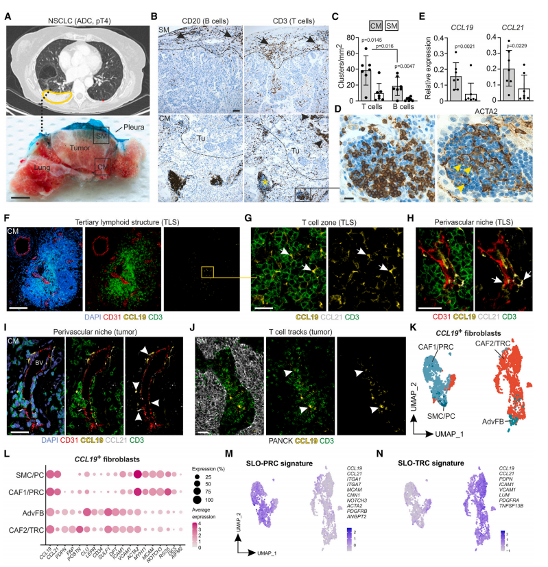 单细胞转录组揭示构建保护性T细胞环境的新机制