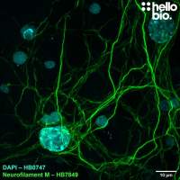 Anti-Neurofilament M (NF-M) antibody ValidAb  TM
