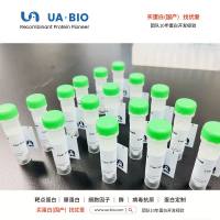 HBV Surface Antigen-preS1 Protein【中文名称：乙肝表面抗原-前S1蛋白】, 国产蛋白专家-南京优爱