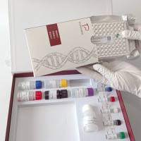 Menangle Virus梅拉哥病毒探针法荧光定量RT-PCR试剂盒