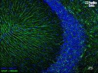 Anti-GFAP antibody ValidAb TM