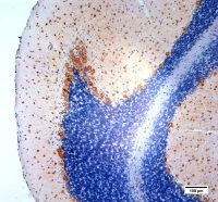 Modified Mayer's Hematoxylin