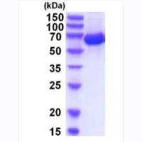 Recombinant Human Serum Albumin(≥99%, lipid rich, liquid)
