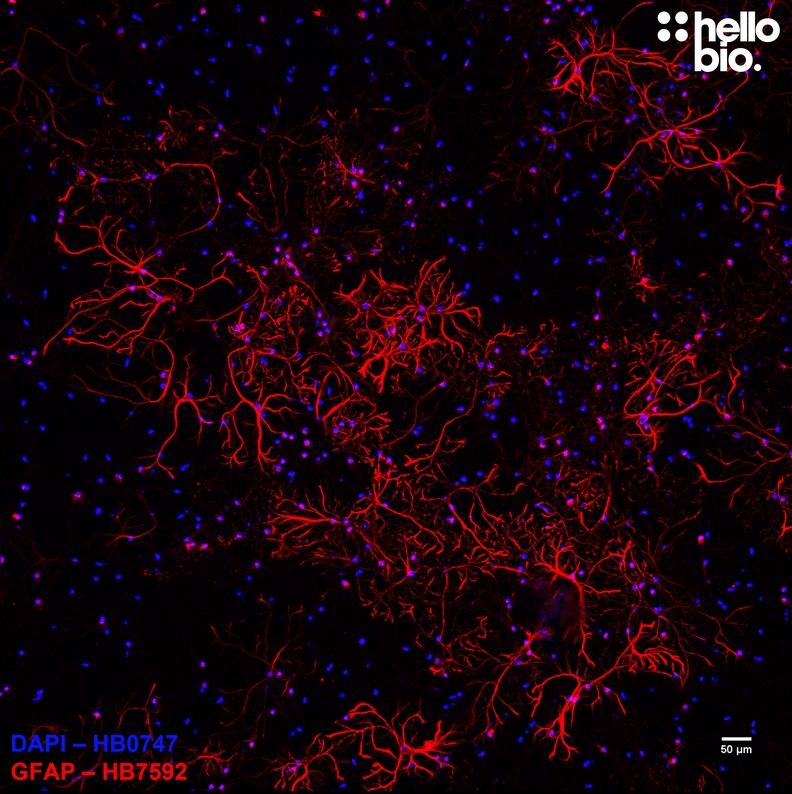 Anti-GFAP antibody ValidAb™