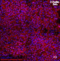 MightyMount TM Antifade Fluorescence Mounting