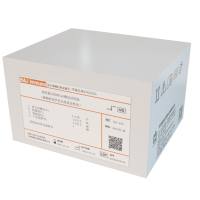 抗线粒体 M2 型抗体 IgG 测定试剂盒 （磁微粒化学发光免疫分析法）