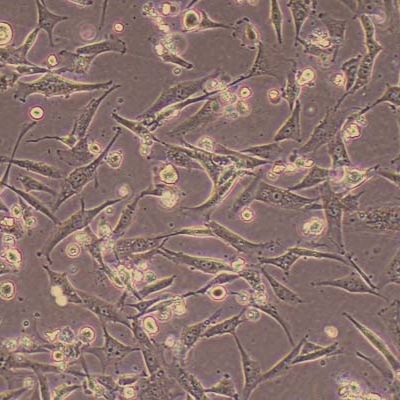 HSF人皮肤成纤维细胞(免疫荧光鉴定)