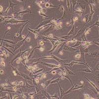 HSF人皮肤成纤维细胞(免疫荧光鉴定)