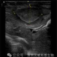 兔子肝癌模型构建