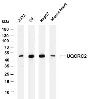 UQCRC2 (PT0170R) PT® Rabbit mAb