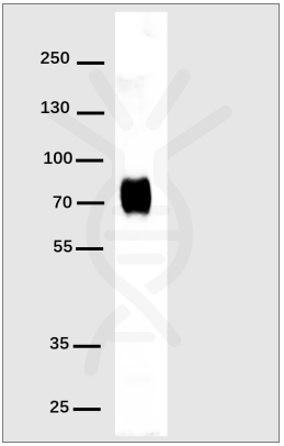 DIMA BIOTECH-抗His标签抗体(DM1),兔单克隆抗体实验材料超值购