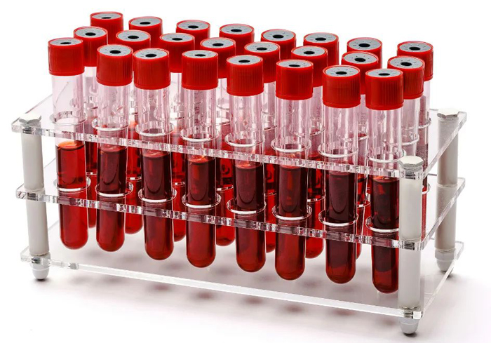 聚焦!真空离心浓缩仪血清浓缩实验案例分享