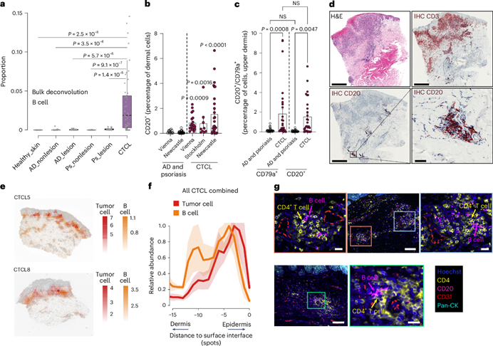 Nature Immunology | Tissue Cytometry技术助力揭示CTCL病变中B细胞与恶性T细胞的相互作用