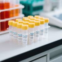 降钙素原(PCT)单克隆抗体；降钙素原抗体；PCT抗体