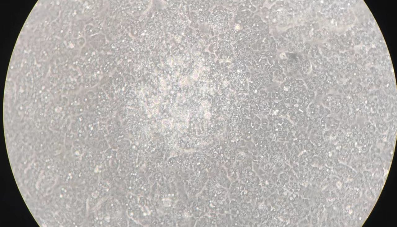 缺氧环境细胞培养特点在建系-开发建库前统计