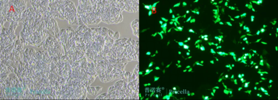 用EGFP表达质粒转染Hep G2细胞48 小时后的荧光蛋白表达效果图