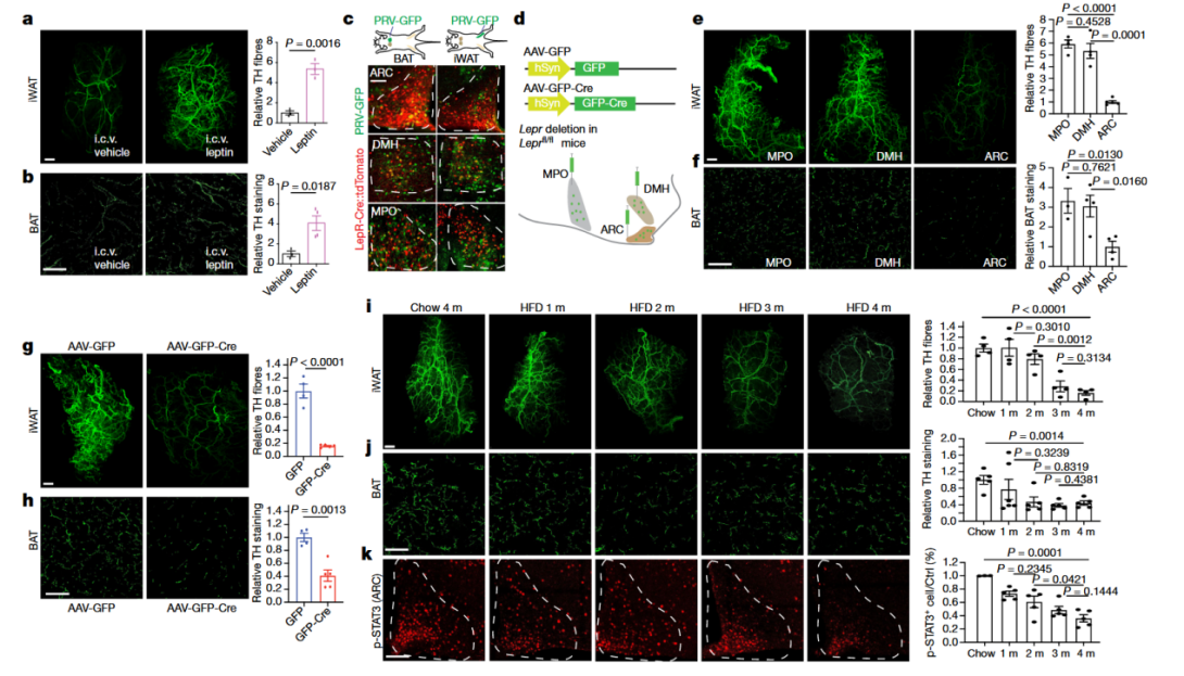 《Nature》：脂肪组织三维透明成像揭示肥胖群体脂肪组织中受交感神经支配的关键信号通路