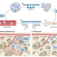 负载藤黄酸(GA)的PLGA纳米颗粒被结肠癌细胞膜(CCM)包裹