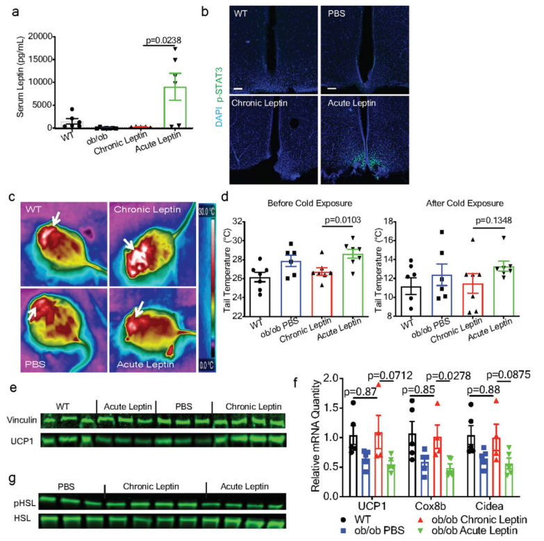 《Nature》：脂肪组织三维透明成像揭示肥胖群体脂肪组织中受交感神经支配的关键信号通路