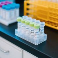 鼠抗肌红蛋白单克隆抗体；肌红蛋白（MYO）单克隆抗体；肌红蛋白抗体；MYO抗体