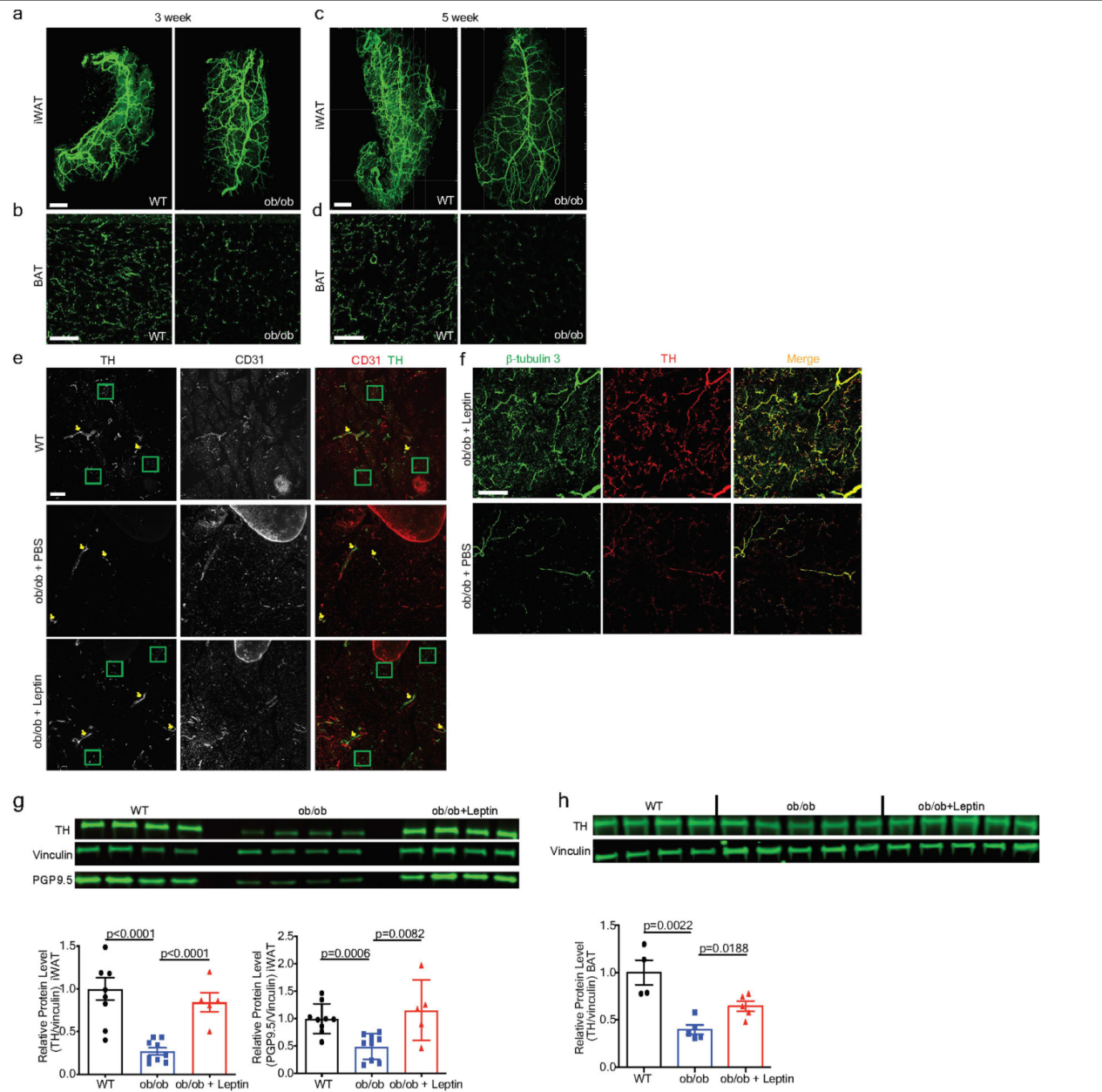 《Nature》：脂肪组织三维透明成像揭示肥胖群体脂肪组织中受交感神经支配的关键信号通路
