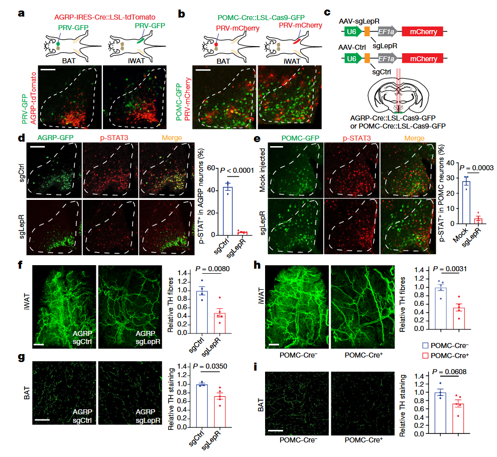 《Nature》：脂肪组织三维透明成像揭示肥胖群体脂肪组织中受交感神经支配的关键信号通路