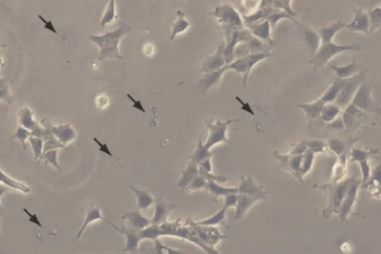 细胞污染类型及预防细胞污染措施综述