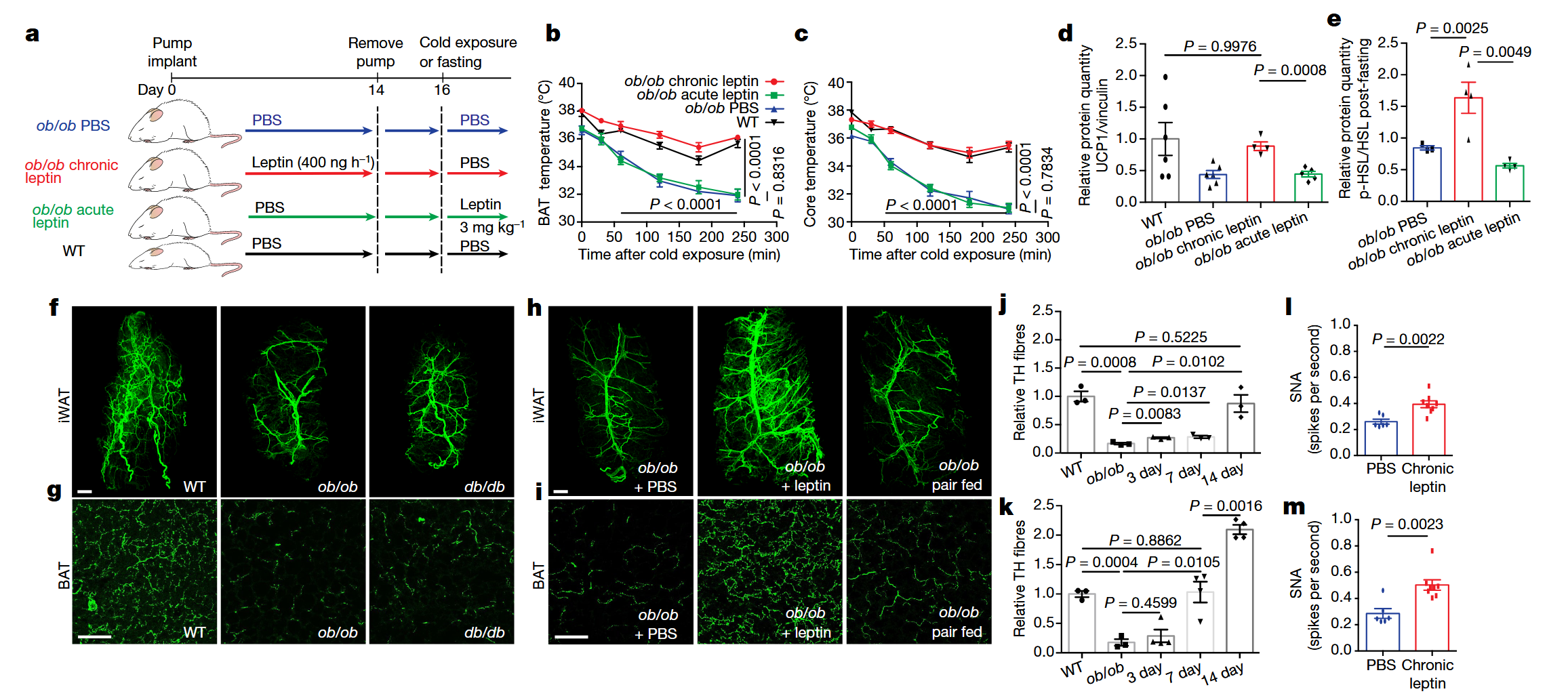 《Nature》：脂肪组织三维透明成像揭示肥胖群体脂肪组织中受交感神经支配的关键信号通路
