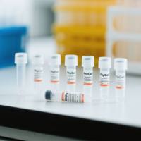 鼠抗转铁蛋白单克隆抗体；转铁蛋白抗体；Transferrin-mAb