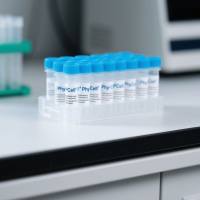 鼠抗D-二聚体单克隆抗体；D-二聚体单克隆抗体；D-二聚体抗体