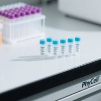 鼠抗N端脑利钠肽前体单克隆抗体；鼠抗脑利钠肽单克隆抗体；NT-proBNP单克隆抗体；B 型利钠肽抗体;NT-proBNP-McAb；BNP-McAb