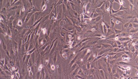 人胃癌细胞NUGC4説明书