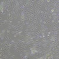 人原代脉络丛上皮细胞